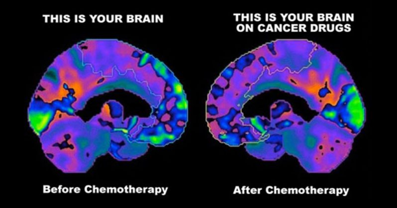 CANCER: Effects of ‘chemobrain’ seem to disappear after a few , The Boston Globe, Health and Science